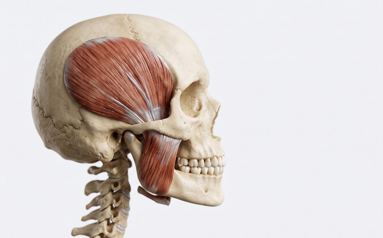 Anatomical render of the masseter and temporalis muscles of mastication on a human skull